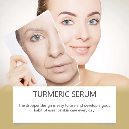 Hoygi Turmeric Essence Face Serum – Hydrating, Brightening & Rejuvenating Skincare for Nourished, Glowing Skin|The Trendora Vault|
