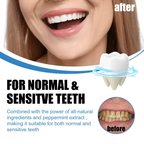 EELHOE Whitening Toothbrush – Removes Yellow Dirt & Stains for Clean, White Teeth, Effective Tooth Care |The Trendora Vault|