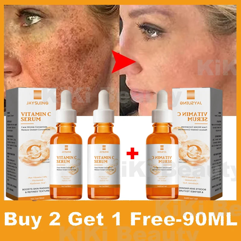 Vitamin C Whitening Serum – Dark Spot Remover, Freckle Fading & Brightening Face Serum for Even Skin Tone & Anti-Wrinkle Care |The Trendora Vault|