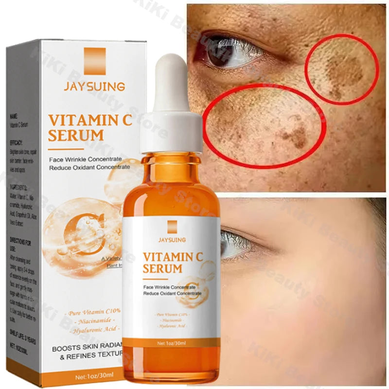 Vitamin C Whitening Serum – Dark Spot Remover, Freckle Fading & Brightening Face Serum for Even Skin Tone & Anti-Wrinkle Care |The Trendora Vault|