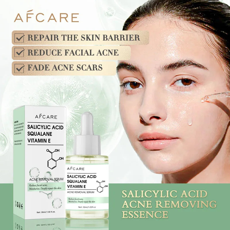 Anti-Acne Face Serum with Salicylic Acid – Acne Removing, Brightening & Moisturizing Korean Skincare with Squalane & Vitamin E |The Trendora Vault|