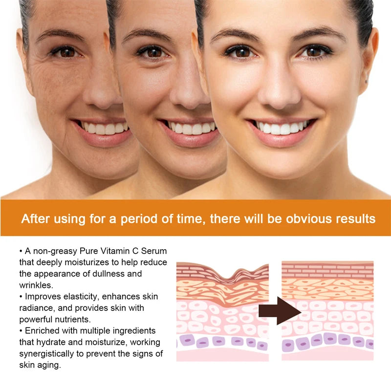 Vitamin C Whitening Serum – Dark Spot Remover, Freckle Fading & Brightening Face Serum for Even Skin Tone & Anti-Wrinkle Care |The Trendora Vault|