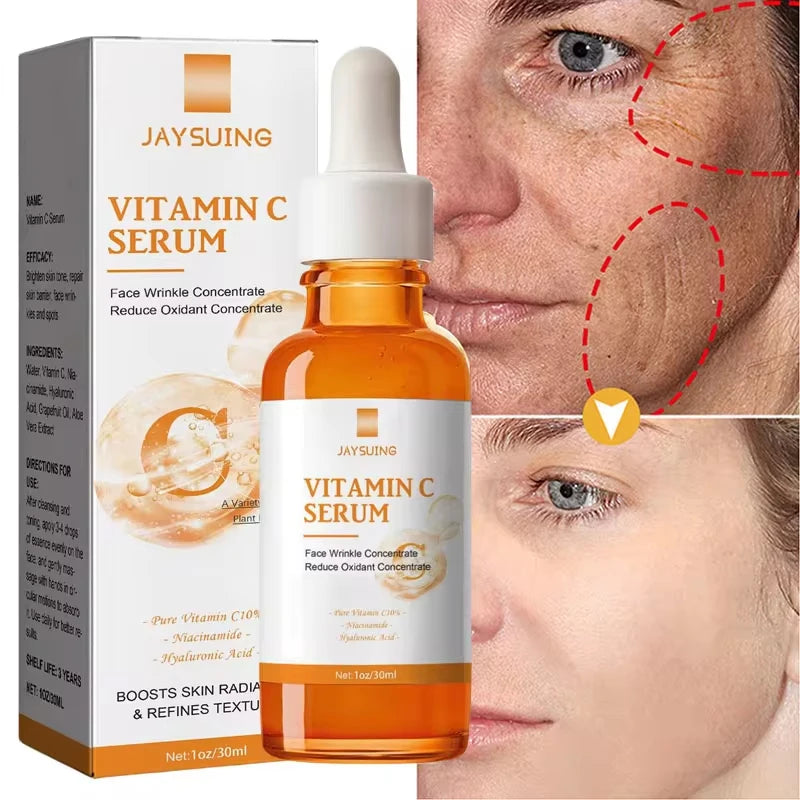 Vitamin C Whitening Serum – Dark Spot Remover, Freckle Fading & Brightening Face Serum for Even Skin Tone & Anti-Wrinkle Care |The Trendora Vault|