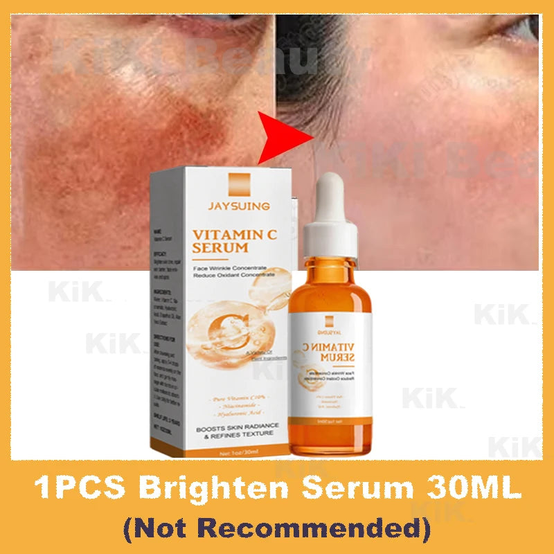 Vitamin C Whitening Serum – Dark Spot Remover, Freckle Fading & Brightening Face Serum for Even Skin Tone & Anti-Wrinkle Care |The Trendora Vault|