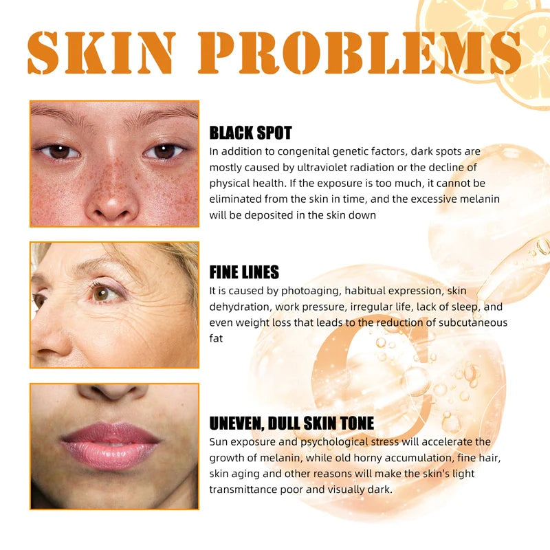 Vitamin C Whitening Serum – Dark Spot Remover, Freckle Fading & Brightening Face Serum for Even Skin Tone & Anti-Wrinkle Care |The Trendora Vault|