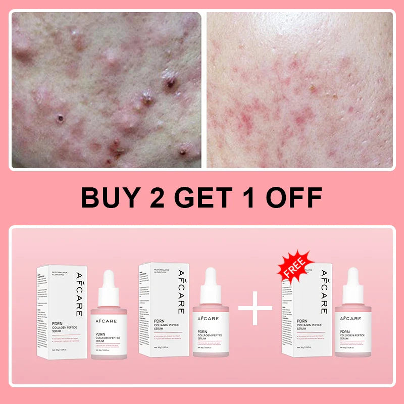 Collagen Peptide Facial Serum Targets Dull Skin Boosts Skin Elasticity Stimulates Skin Renewal Repair Salmon PDRN KOREAN Product || The Trendora Vault|